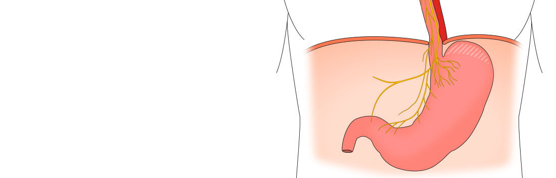 Darstellung einer intakten Anatomie des Zwerchfells sowie Speiseröhre